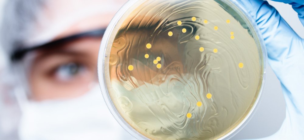 m/تشخیص استاف در محصولات پزشکی