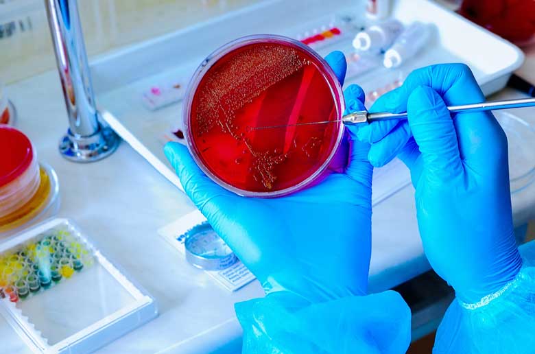 m/بار میکروبی